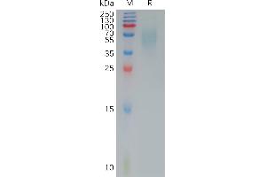 SDS-PAGE (SDS) image for CD200 Receptor 1 (CD200R1) (AA 29-243) protein (His tag) (ABIN6964147)