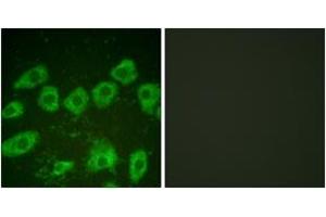 Immunofluorescence (IF) image for anti-Tyrosine Hydroxylase (TH) (AA 10-59) antibody (ABIN2888583) (Tyrosine Hydroxylase Antikörper  (AA 10-59))