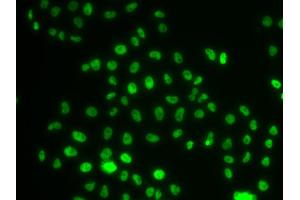 Immunofluorescence analysis of MCF-7 cells using PHIP antibody.