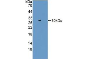 Western blot analysis of recombinant Human LACTb. (LACTB Antikörper  (AA 313-547))