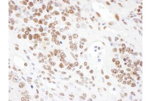 Immunohistochemistry (IHC) image for anti-Serrate RNA Effector Molecule Homolog (SRRT) (AA 826-876) antibody (ABIN7453421) (SRRT Antikörper  (AA 826-876))