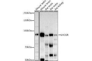 Western blot analysis of extracts of various cell lines, using LHCGR antibody (ABIN6128180, ABIN6143185, ABIN6143186 and ABIN6221866) at 1:500 dilution. (LHCGR Antikörper  (AA 200-360))