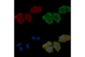 ABIN6262231 and ABIN6279482 staining Hela cells(30 min of UV treatment) by IF/ICC.