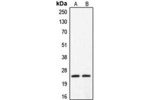 Western blot analysis of Claudin 2 expression in HeLa (A), A431 (B) whole cell lysates. (Claudin 2 Antikörper  (C-Term))