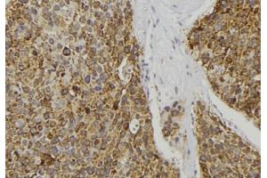 ABIN6277085 at 1/100 staining Human pancreas tissue by IHC-P.