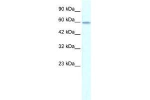 WB Suggested Anti-ZNF543 Antibody Titration:  0. (ZNF543 Antikörper  (Middle Region))