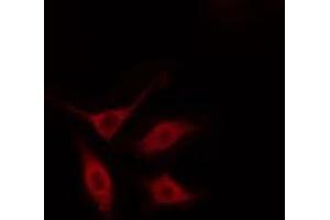 ABIN6274485 staining HeLa cells by IF/ICC. (SERINC2 Antikörper  (Internal Region))