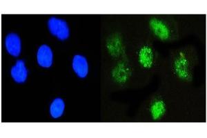 IF analysis of NFIA using anti-NFIA antibody (ABIN6719349). (NFIA Antikörper  (Middle Region))