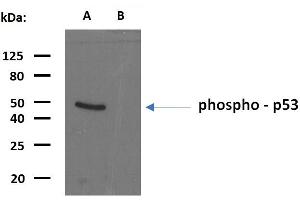 Western blotting analysis of phosphorylated human p53 using mouse monoclonal antibody FP3. (p53 Antikörper  (pSer392))
