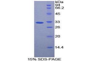 SDS-PAGE (SDS) image for Caspase 12 (Gene/pseudogene) (CASP12) (AA 1-244) protein (His tag) (ABIN1878851)