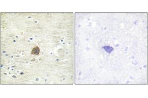 Immunohistochemical analysis of paraffin-embedded human brain tissue using CaMKII (Phospho-Thr305) antibody (left)or the same antibody preincubated with blocking peptide (right). (CAMK2A Antikörper  (pThr305))