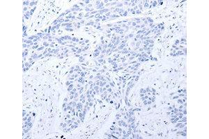 Immunohistochemistry (IHC) image for anti-Gastrin-Releasing Peptide Receptor (GRPR) antibody (ABIN1872904) (GRPR Antikörper)