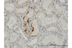 Immunoperoxidase of monoclonal antibody to ESM1 on formalin-fixed paraffin-embedded human kidney.