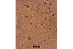 Formalin-fixed and paraffin-embedded human brain reacted with HSP Antibody (Center), which was peroxidase-conjugated to the secondary antibody, followed by DAB staining. (BRISC and BRCA1 A Complex Member 1 (BABAM1) (AA 116-143) Antikörper)