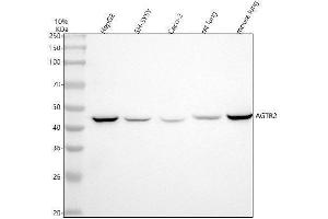 Western blot analysis of AGTR2 using anti-AGTR2 antibody (ABIN7603926).