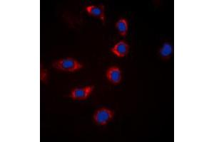 Immunofluorescent analysis of BAD (pS155) staining in Hela cells. (BAD Antikörper  (C-Term, pSer155))