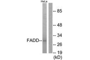 Western blot analysis of extracts from HeLa cells, treated with PMA 125ng/ml 30', using FADD (Ab-194) Antibody. (FADD Antikörper  (AA 159-208))