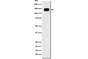 Western blot analysis of GTF2I expression in Jurkat cell lysate.