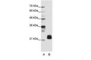 Image no. 2 for anti-Transmembrane Emp24 Protein Transport Domain Containing 4 (TMED4) (N-Term) antibody (ABIN202093)