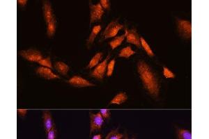 Immunofluorescence analysis of C6 cells using BTRC Polyclonal Antibody at dilution of 1:100. (BTRC Antikörper)