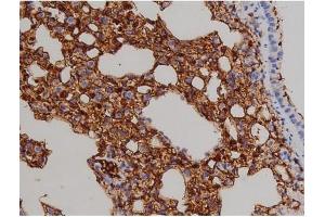ABIN6267521 at 1/200 staining Mouse lung2.