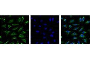 Immunofluorescence (IF) analysis of HeLa with antibody (Left) and DAPI (Right) diluted at 1:100. (Aquaporin 4 Antikörper)