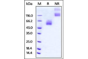 SDS-PAGE (SDS) image for CD47 (CD47) (AA 19-140) (Active) protein (Fc Tag) (ABIN4949205)