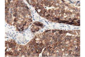 Immunohistochemistry (IHC) image for anti-DnaJ (Hsp40) Homolog, Subfamily A, Member 2 (DNAJA2) antibody (ABIN1497861) (DNAJA2 Antikörper)