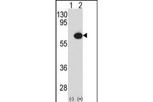 Western blot analysis of P3K7IP1 (arrow) using rabbit polyclonal P3K7IP1-p (ABIN390847 and ABIN2841073). (TAB1 Antikörper  (AA 416-445))