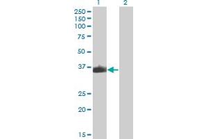 Western Blot analysis of ZNF187 expression in transfected 293T cell line by ZNF187 monoclonal antibody (M04), clone 3E11. (ZNF187 Antikörper  (AA 1-325))