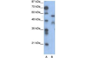 WB Suggested Anti-NFIA Antibody Titration:  0. (NFIA Antikörper  (Middle Region))