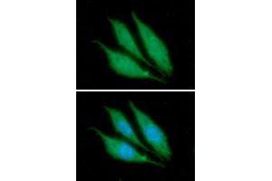 ICC/IF analysis of KRT14 in PC3 cells. (KRT14 Antikörper  (AA 1-472))