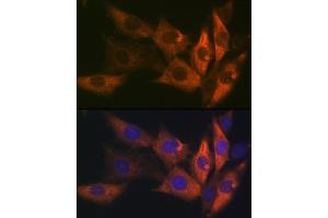 Immunofluorescence analysis of NIH-3T3 cells using AMPKβ1 Rabbit mAb (ABIN7269654) at dilution of 1:100 (40x lens). (PRKAB1 Antikörper)