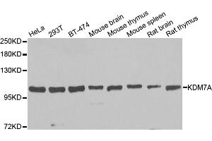 Western blot analysis of extracts of various cell lines, using KDM7A antibody. (JHDM1D Antikörper)