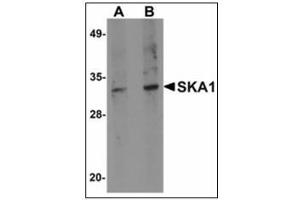 Western blot analysis of SKA1 in A549 cell lysate with SKA1 antibody at (A) 0. (SKA1 Antikörper  (C-Term))
