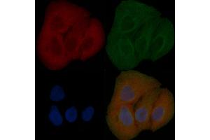 CEP104 Mouse Monoclonal Antibody staining Hela cells by IF/ICC. (KIAA0562 Antikörper)
