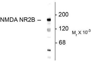 Image no. 1 for anti-Glutamate Receptor, Ionotropic, N-Methyl D-Aspartate 2B (GRIN2B) (N-Term) antibody (ABIN372684) (GRIN2B Antikörper  (N-Term))