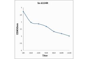 Antigen: 0. (Nibrin Antikörper  (AA 641-754))