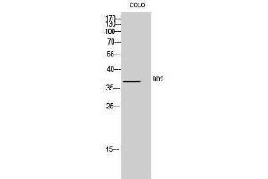 Western Blotting (WB) image for anti-Aldo-keto Reductase Family 1, Member C2 (AKR1C2) (Internal Region) antibody (ABIN3184266) (AKR1C2 Antikörper  (Internal Region))