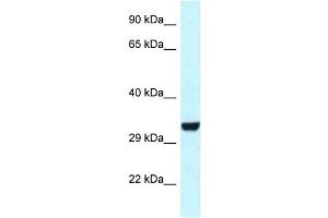 WB Suggested Anti-Hey1 Antibody   Titration: 1. (HEY1 Antikörper  (C-Term))