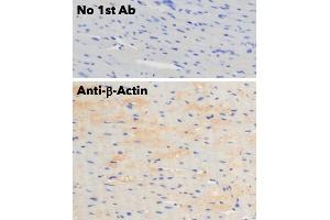 Immunohistochemistry (IHC) image for anti-Actin, beta (ACTB) (N-Term) antibody (ABIN6254200) (beta Actin Antikörper  (N-Term))