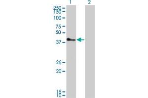 Western Blot analysis of TRIM52 expression in transfected 293T cell line by TRIM52 monoclonal antibody (M01), clone 6D5. (TRIM52 Antikörper  (AA 201-297))