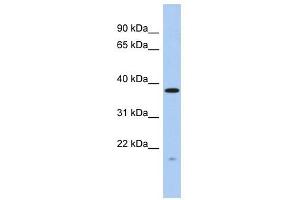 RWDD2A antibody used at 1 ug/ml to detect target protein. (RWDD2A Antikörper  (N-Term))