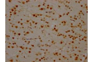 Immunohistochemistry (IHC) image for anti-Synaptotagmin Binding, Cytoplasmic RNA Interacting Protein (SYNCRIP) antibody (ABIN7127546)