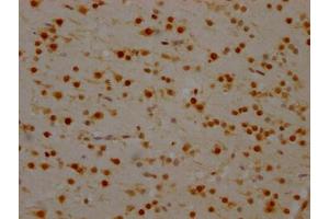 IHC image of ABIN7127546 diluted at 1:100 and staining in paraffin-embedded human brain tissue performed on a Leica BondTM system. (Rekombinanter SYNCRIP Antikörper)