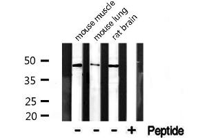 Western blot analysis of extracts from various tissue, using CADM4 antibody. (Cell Adhesion Molecule 4 Antikörper  (C-Term))