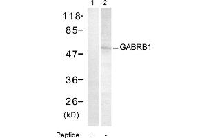 Image no. 1 for anti-gamma-aminobutyric Acid (GABA) A Receptor, Subunit beta 1 (GABRB1) (Ser434) antibody (ABIN319328) (GABRB1 Antikörper  (Ser434))
