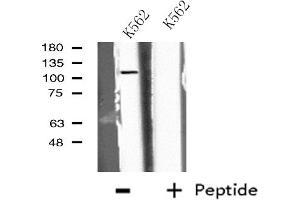 Western blot analysis of extracts from K562 cells, using EPB41L2 antibody.