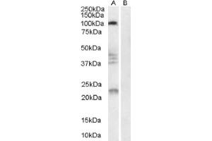 Image no. 1 for anti-Reticulon 4 Receptor (RTN4R) (Internal Region) antibody (ABIN374563) (RTN4R Antikörper  (Internal Region))