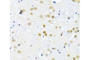 Immunohistochemistry of paraffin-embedded Mouse brain using ITGB3BP Polyclonal Antibody at dilution of 1:100 (40x lens). (ITGB3BP Antikörper)